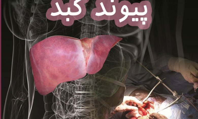 در صورت داشتن این شرایط قبلی آیا می توانم پیوند کبد انجام دهم؟