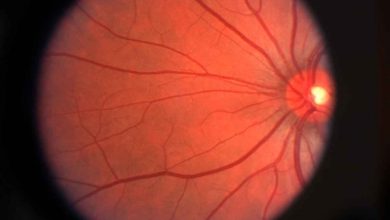 شبکیه مصنوعی بیوهیبرید با هدف بازگرداندن بینایی به وسیله سلولهای زنده بیماری دژنراسیون ماکولا یا AMD